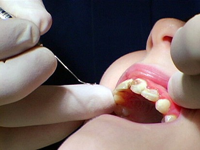 VIDEO: PepsiCo to support Appalachia dentists