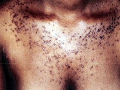 VIDEO: The Dangers of Becoming White