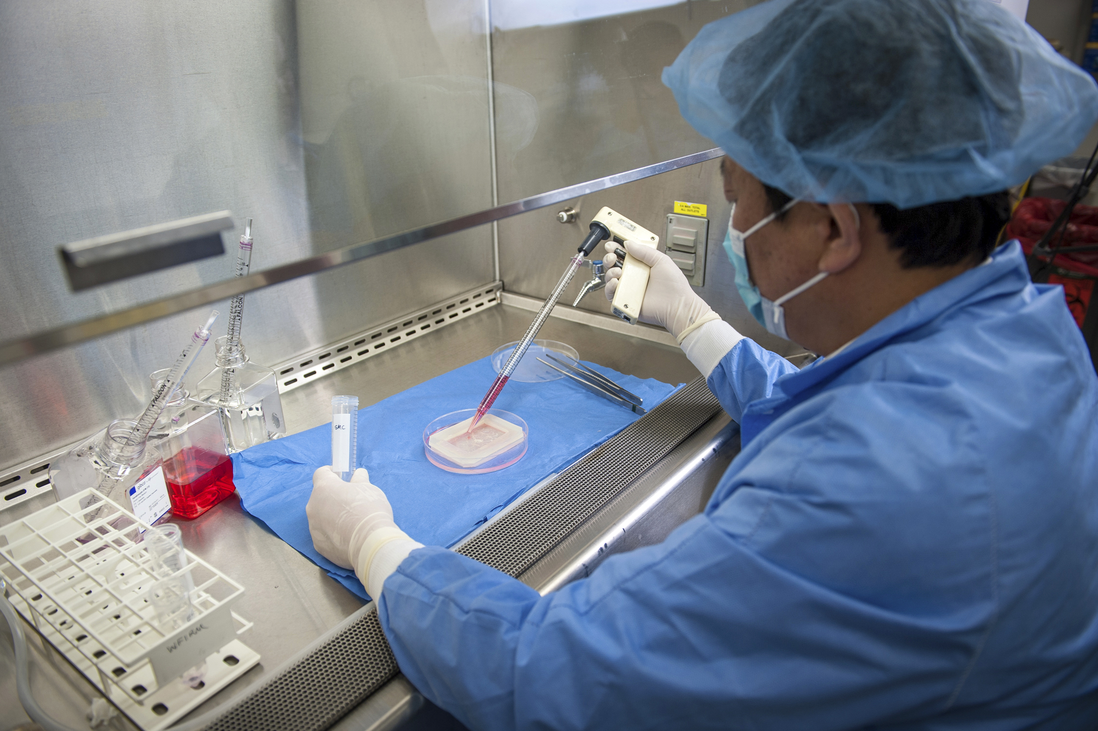 PHOTO: Yuanyuan Zhang, an assistant professor at the Institute, demonstrates the process to engineer a vaginal organ in a laboratory in Winston Salem, N.C. in this photo issued by Wake Forest Institute for Regenerative Medicine and taken in April 2014.