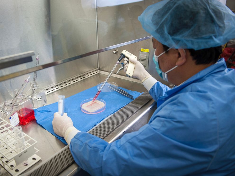 PHOTO: Yuanyuan Zhang, an assistant professor at the Institute, demonstrates the process to engineer a vaginal organ in a laboratory in Winston Salem, N.C. in this photo issued by Wake Forest Institute for Regenerative Medicine and taken in April 2014.